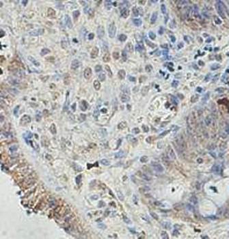 AKIRIN2 Rabbit Polyclonal Antibody