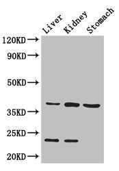 AKR1A1 Antibody