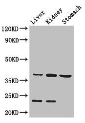 AKR1A1 antibody