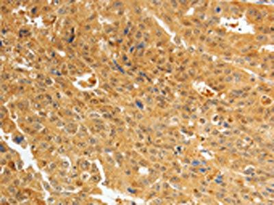 AKR1A1 Antibody