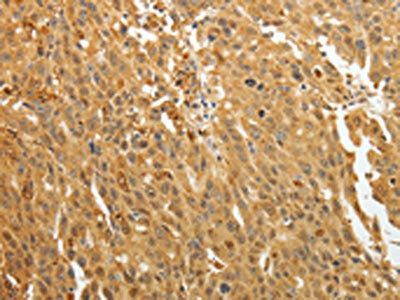 AKR1A1 Antibody