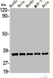 AKR1A1 Antibody
