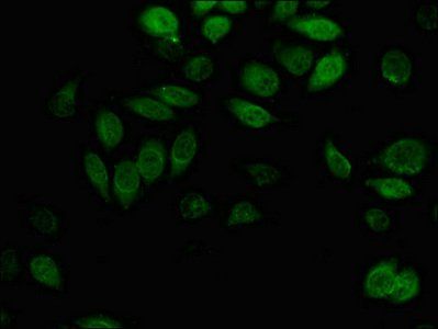 AKR1B1 Antibody