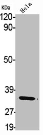 AKR1B1 Antibody