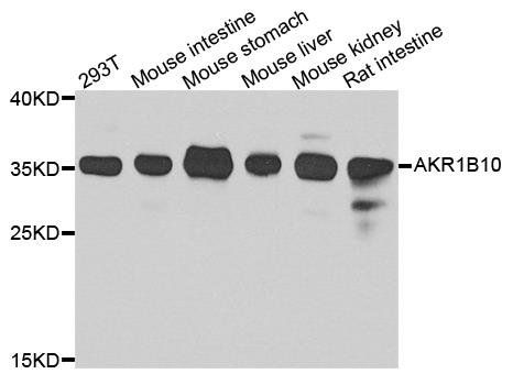 AKR1B10 antibody