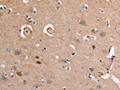 AKR1B10 Antibody