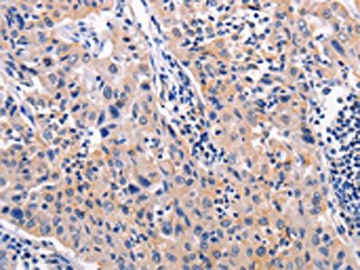 AKR1B10 Antibody