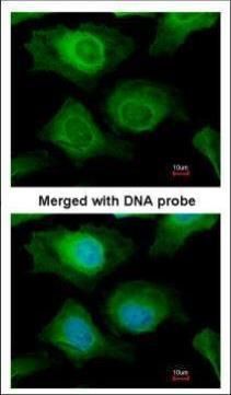 aldo-keto reductase family 1 member B10 Antibody