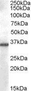 AKR1B10 antibody