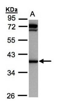 AKR1C1 antibody