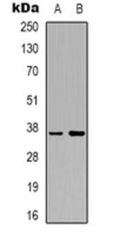 AKR1C2 antibody