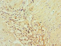 AKR1C3 Antibody