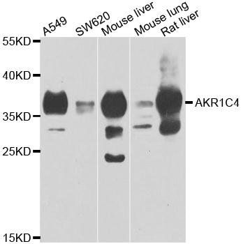 AKR1C4 antibody