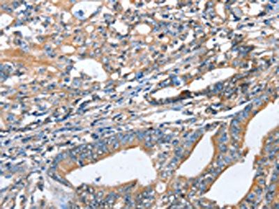 AKR1D1 Antibody