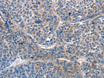 AKR1D1 antibody