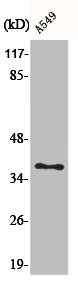 AKR1E2 antibody