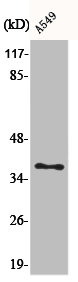 AKR1E2 Antibody