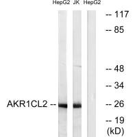 AKR1E2 antibody