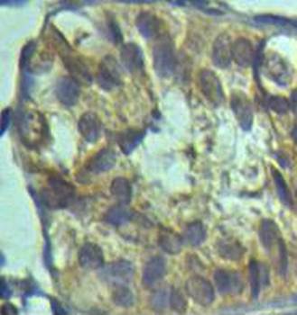 AKR1E2 Rabbit Polyclonal Antibody