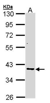 AKR7 antibody