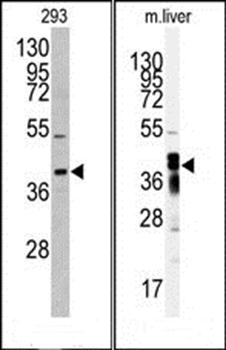 AKR7A2 antibody