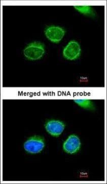 aldo-keto reductase family 7 member A2 Antibody