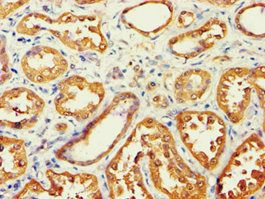 AKR7A3 Antibody
