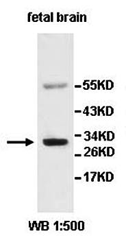 AKR7L antibody