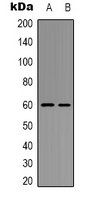 AKT (phospho-Y326) antibody