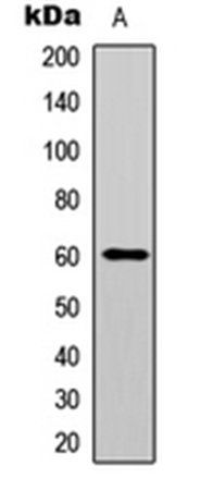 AKT (phospho-Y474) antibody