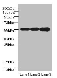 AKT1 Antibody