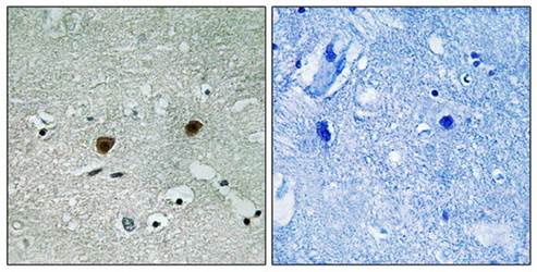 AKT1/2/3 (Phospho-Tyr315/316/312) Antibody