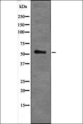 AKT1 (Phospho-Ser473+Tyr474) antibody