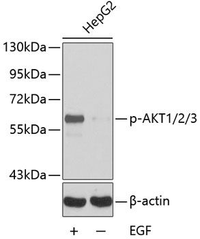 AKT1 (Phospho-Y315/AKT2-Y316/AKT3-Y312) antibody