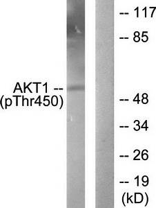 Akt1 (Phospho-Thr450) Antibody