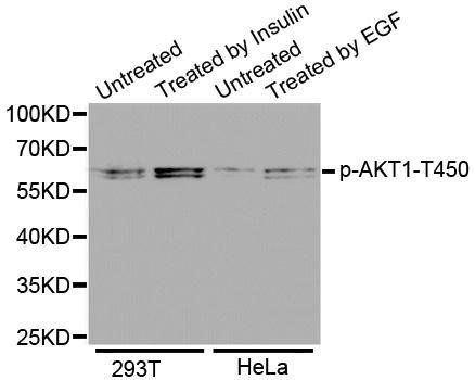 AKT (phospho-T450) antibody