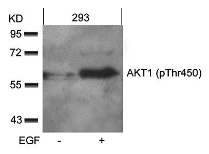 AKT1 (phospho-Thr450) Antibody
