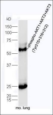 AKT1 (phospho-Tyr315/Tyr316/Tyr312) antibody