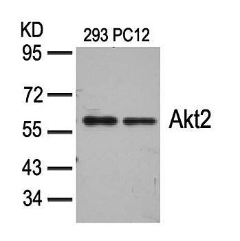 Akt2 (Ab-474) Antibody