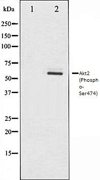 Akt2 (Phospho-Ser474) antibody
