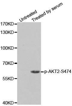 AKT2 (phospho-S474) antibody