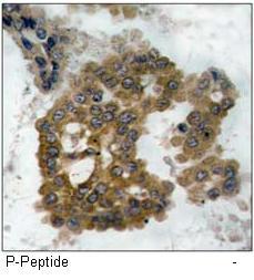 Akt2 (Phospho-Ser474) Antibody