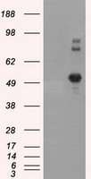 AKT3 antibody