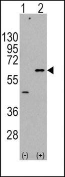 AKT3 antibody