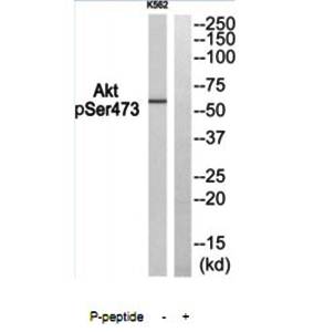AKT (phospho-Ser473) antibody