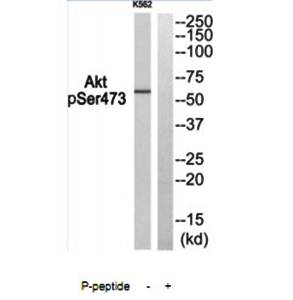 Akt (Phospho-Ser473) Antibody