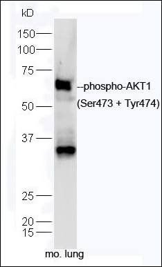 AKT (Phospho-Ser473 + Tyr474) antibody
