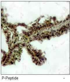 Akt (Phospho-Thr308) Antibody