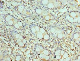 AKTIP Antibody