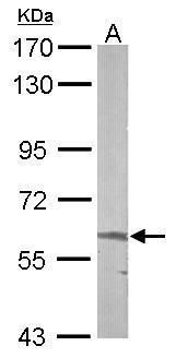 ALAS-E Rabbit Polyclonal Antibody